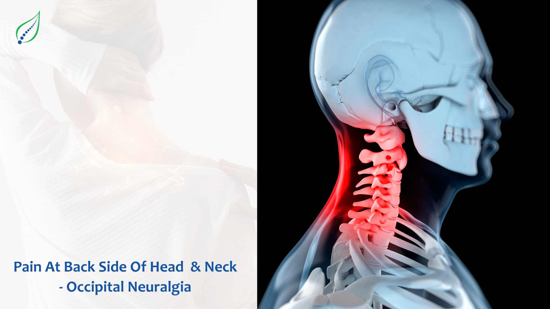 Pain At Back Side Of Head & Neck - Occipital Neuralgia